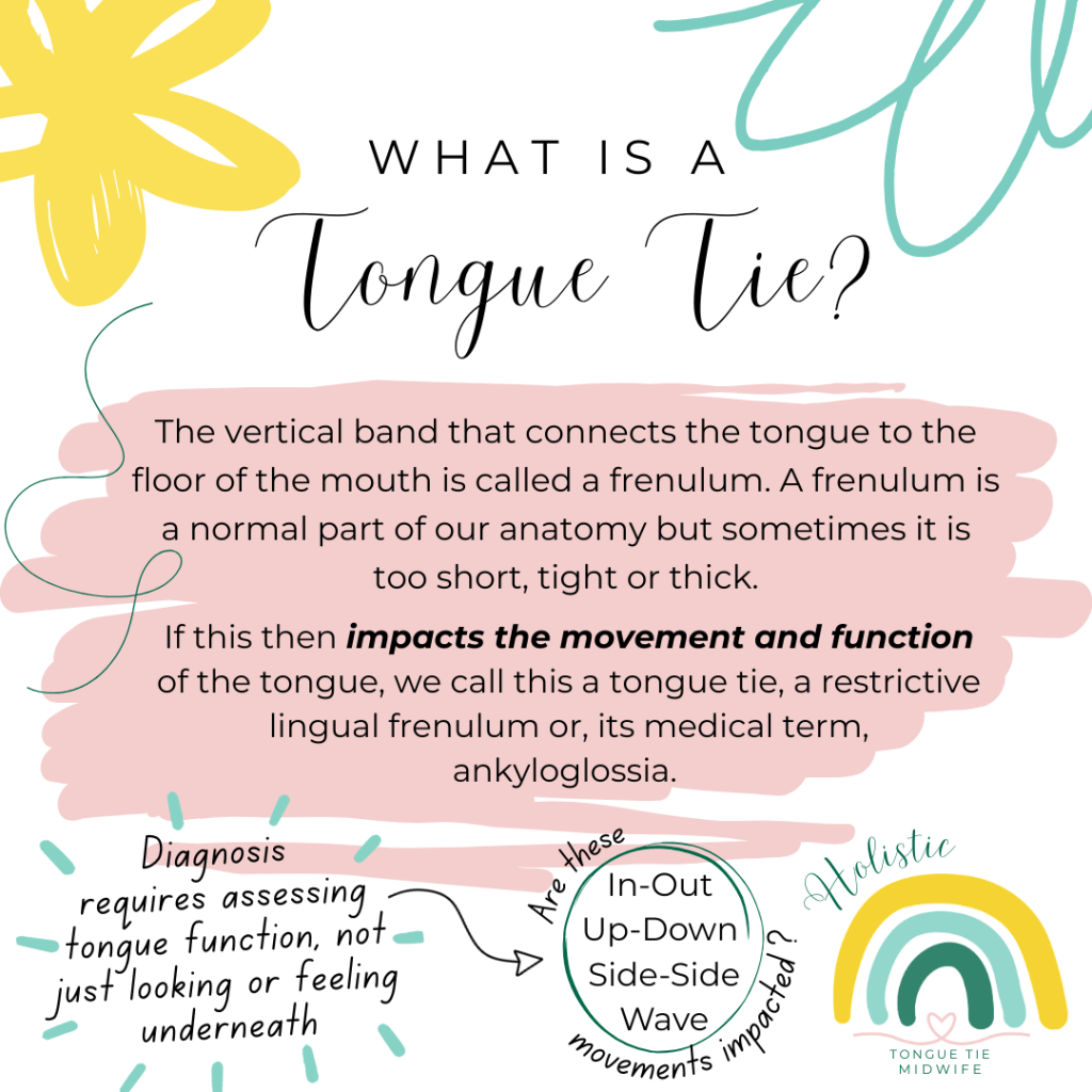Graphic explaining what a tongue tie is, with emphasis on impact of the restriction on tongue function